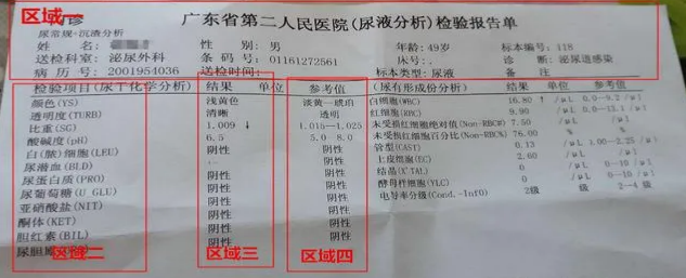 尿液檢查的類型