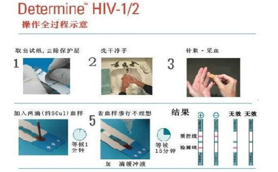 艾滋病检测试纸